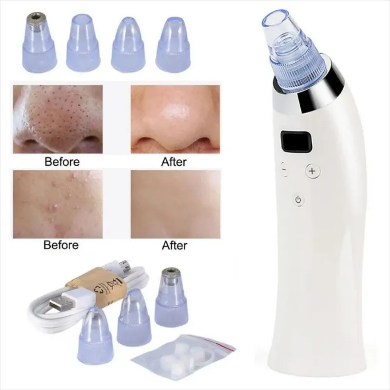 Comprar Extractor Espinilla Puntos Negros Limpia en Electroshopy - Ángulo 2